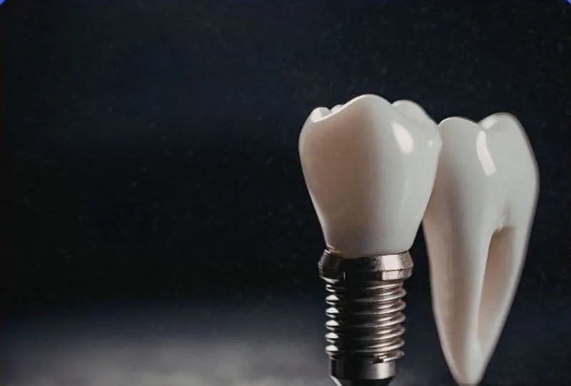 Implante dentário com coroa ao lado de um dente natural